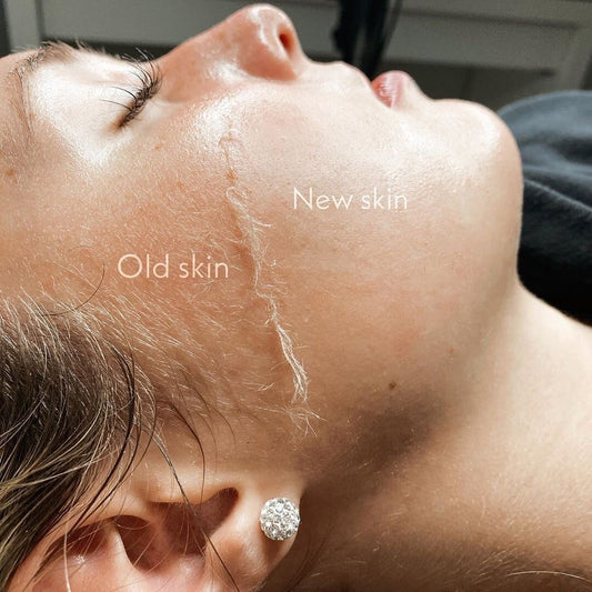 Dermaplane Enhancement